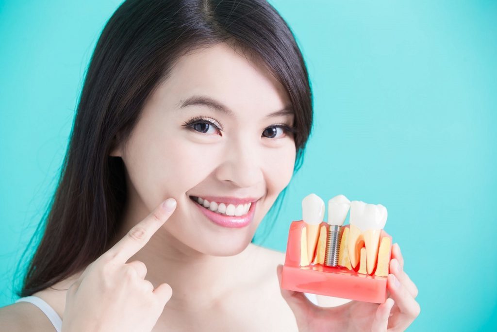 Dental Implants & Restoration Services in Racine, WI Dental Implants & Restoration Services in Racine, WI