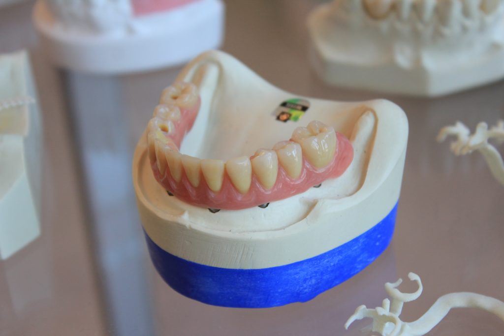Dental Relines & Repairs Services in Racine, WI Dental Relines & Repairs Services in Racine, WI